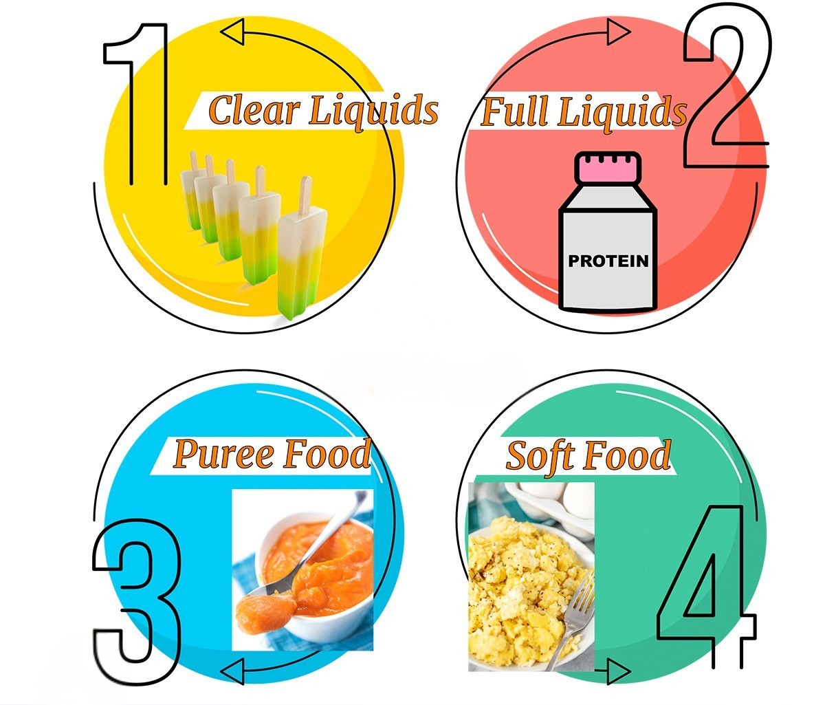 Lifestyle and Diet After Gastric Sleeve Surgery